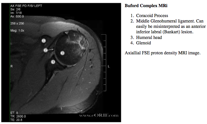 what is the cpt code for mri hip